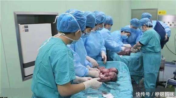 85后孕妈二胎怀四胞胎,宝宝出生后,孕妈哭了丈