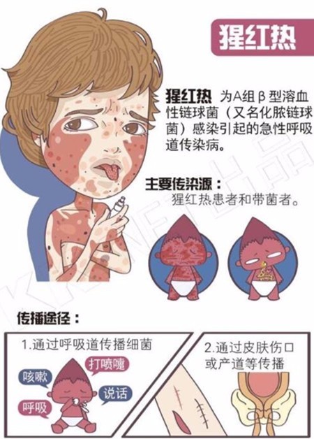 延吉市民提高警惕,我国多地区爆发猩红热