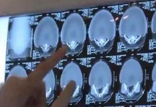 24岁未婚女孩肚子突然变大 原因却说不出口