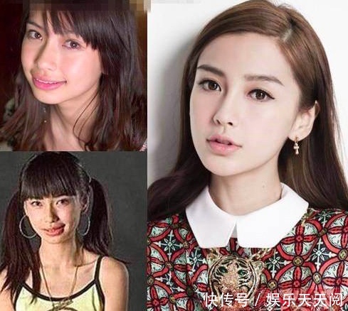 整容没什么,然而有些女明星"打死"也不承认,能不能学学郑爽