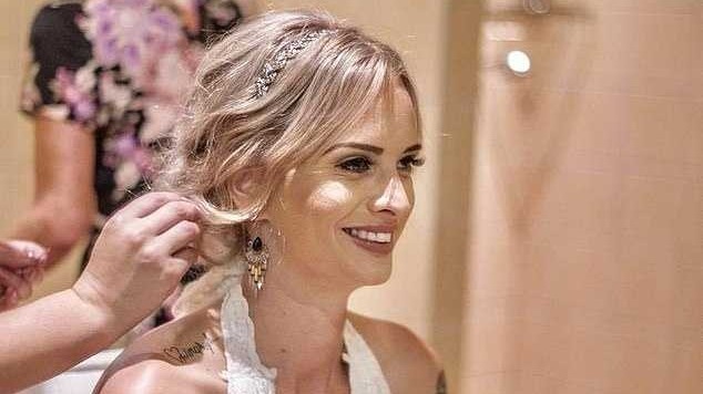 新西兰女子养5条狗打群架 劝架时被狗咬住鲜血直流 新西兰女子养5条狗打群架 劝架时被狗咬住鲜血直流