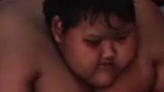 8岁男孩体重异常飙升!