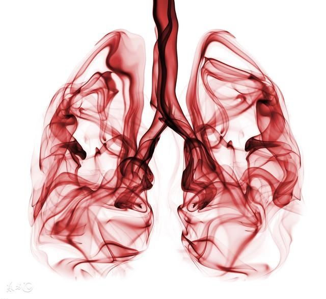 肺部发现边界清楚的肺结节也会癌变吗?2年内