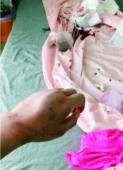 受伤的女人怎么办 t0118626d04180763a4.jpg?size=400x550
