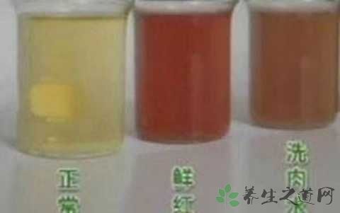 小孩尿红尿是怎么回事