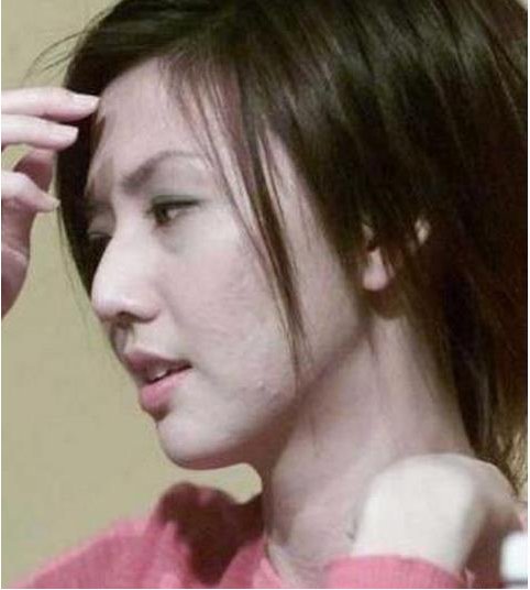 林志玲喝酒过敏,周迅抽烟爆痘痘,明星卸了妆,皮