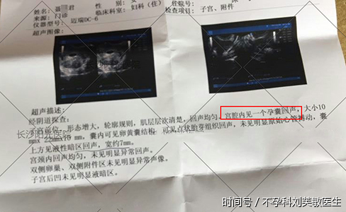 输卵管结扎复通术,找回你的二次生机!