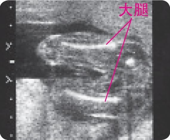通过超声波图片看到孕10个月的胎儿的发育