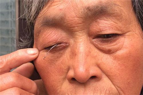 漯河环卫工现状:多数是临时工 干活时受伤难赔