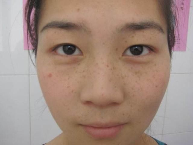 药店里的这种乳膏,祛斑除皱不在话下,坚持半个