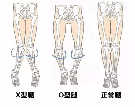 父母發現孩子以下情況,應懷疑↓↓↓ 單手牽拉小孩走路或小孩摔倒