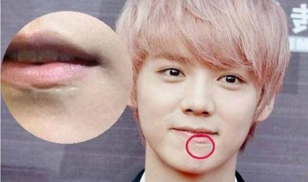 论娱乐圈脸上有疤的明星.鹿晗上榜