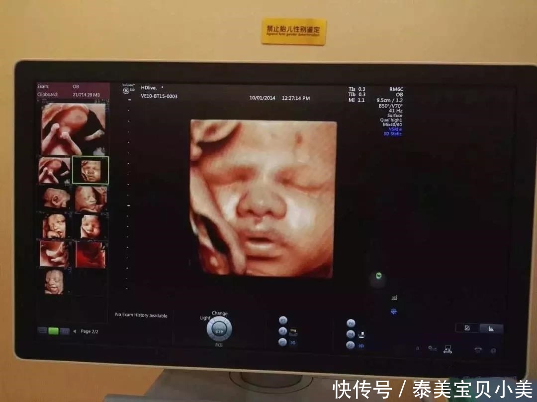 要做几次产检,产检反复照B超对胎儿有影响吗?