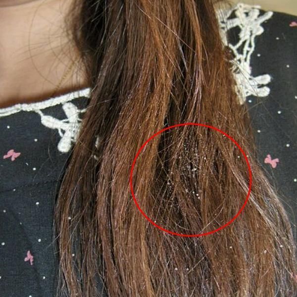 头发分叉要修剪?别去理发店!教你2种方法,自己