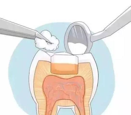 牙齿补好后,能用多久?