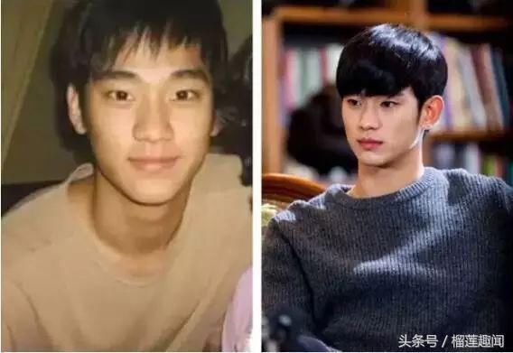 明星出道前后相貌大对比,鹿晗像农村娃吴亦凡