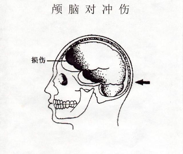 后脑勺部位图及名称图片