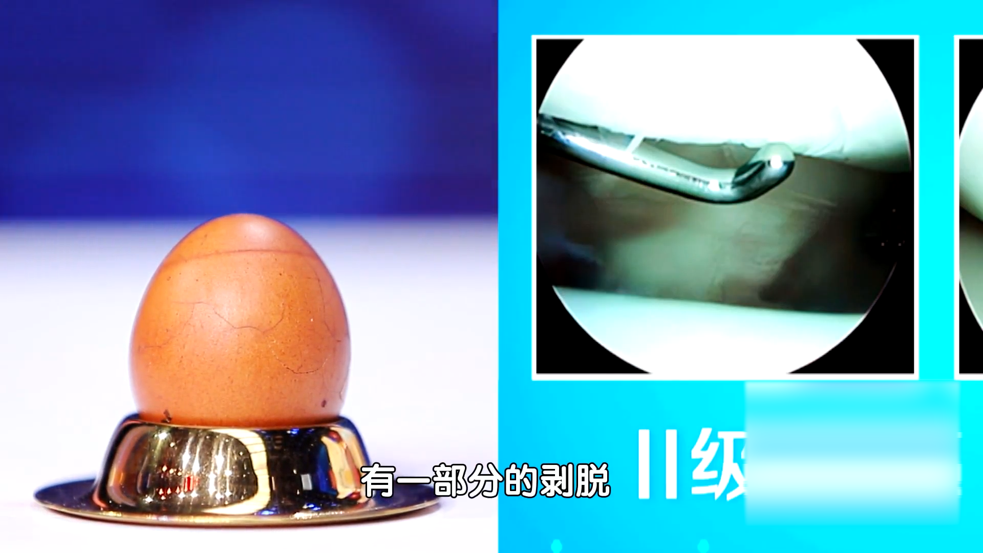养生厨房菜谱：春鲜蚕豆