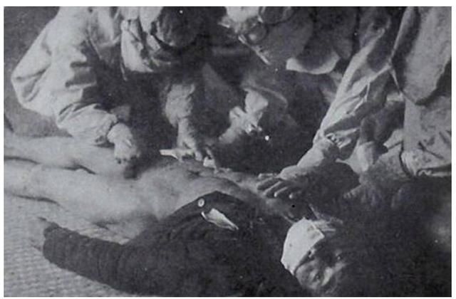 731部队恶名昭著的:骨肉分离实验和活人真空实