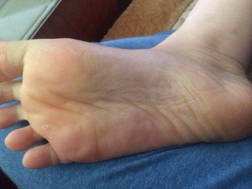 肾好不好"脚"知道,脚上若没出现这3种情况,说明你的肾挺健康