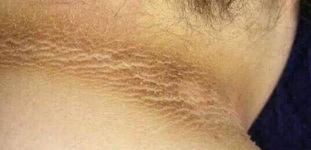 孩子脖子有一圈黑还洗不掉?医生看后笑了,都是