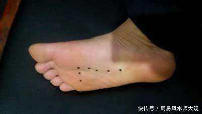 脚底长痣看命运,男人脚底有痣是好是坏?脚踏七