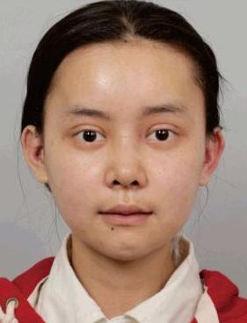 女子花百万整容成baby,公开变脸日记爆红