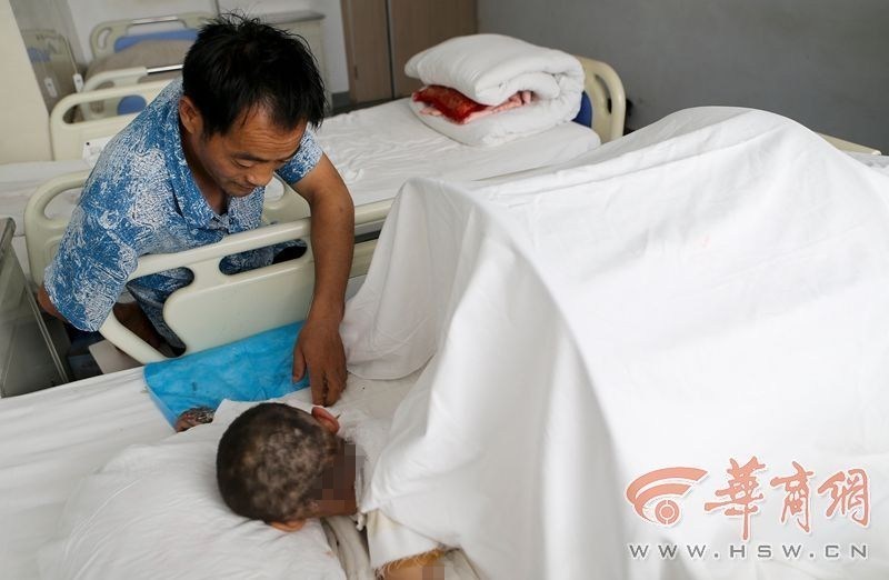 奶奶转身取碗瞬间 3岁女童跌进开水锅