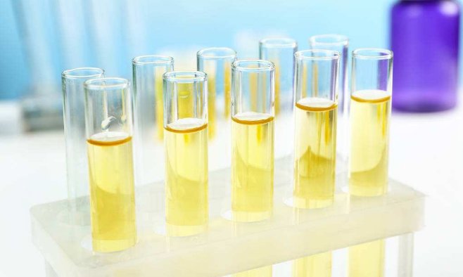 尿蛋白3+很严重吗?是尿毒症前兆吗?看看医生