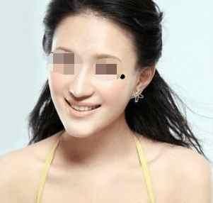 身上这长一痣, 桃花运旺, 男女感情女方比较主动