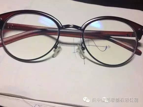 眼镜镜片发黄，需要重新更换眼镜吗?