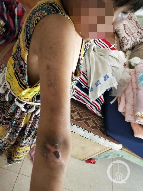 江苏8岁女童被家人吊打虐待遍体鳞伤 警方介入调查