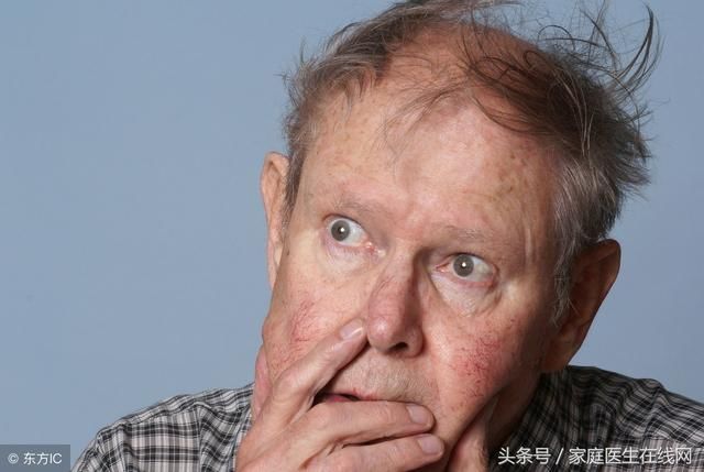 涂抹牙膏或生姜能去老年斑?皮肤科医生做出了