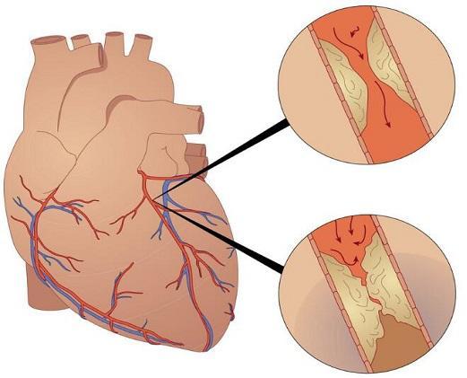看舌头能知心脑血管疾病,一看一个准