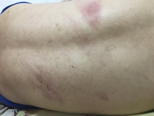 纽约警察执法进错门 华人男子家中睡觉突遭暴打 纽约警察执法进错门 华人男子家中睡觉突遭暴打