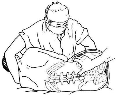 腰椎病经络治疗四大法,腰椎疼痛有救了!