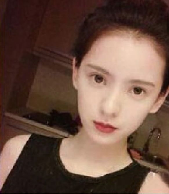 一个洋葱,一瓶白醋,睡前5分钟解决掉你祛斑,三