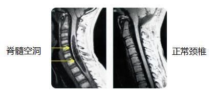 脖子疼、手麻就一定是颈椎病吗?那是因为你不