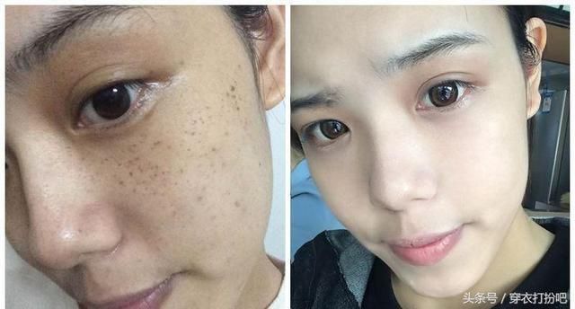 怎么样才能减少脸上的皱纹 t0152777bdb2314af9e.jpg