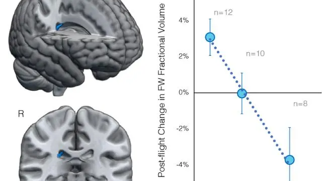 空间飞行时长与间隔影响宇航员大脑结构 空间飞行时长与间隔影响宇航员大脑结构