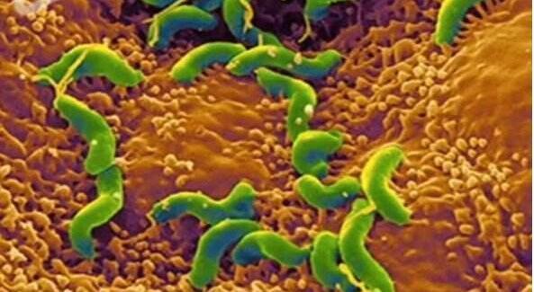 胃病吃四联药物副作用大,还有耐药性,我该怎么