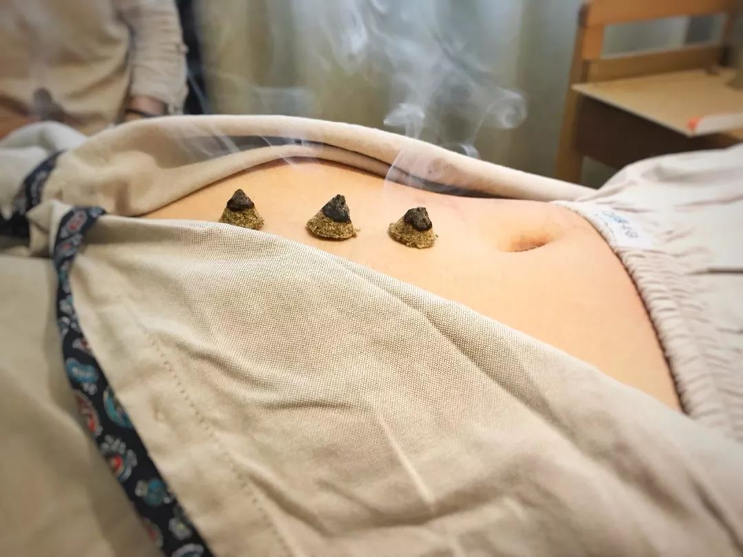 中伏天做艾灸,来自武汉意粉的真人肉测.