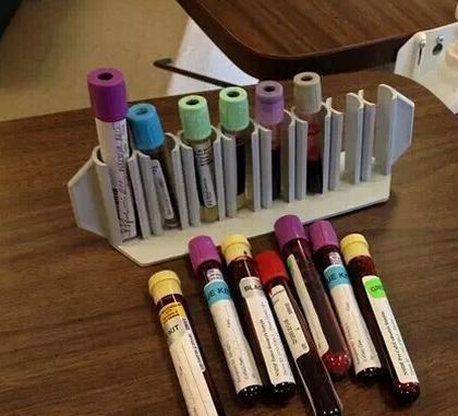 化验单上的血黏度指标为:全血黏度(高切,中切,低切),血浆黏度,血细胞