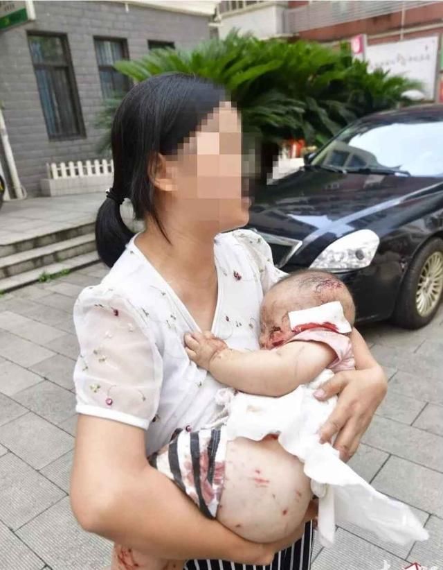 友地位不如狗,狗咬人,真疫苗也不管用,狂犬病致