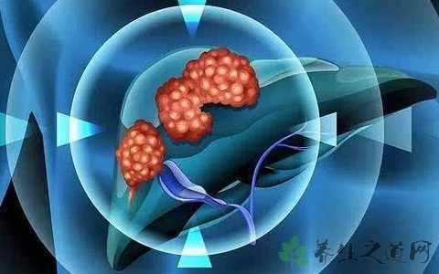 身上长小红点痒是梅毒吗