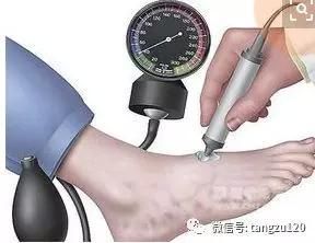 史上最全科普:糖尿病足的临床表现及分级