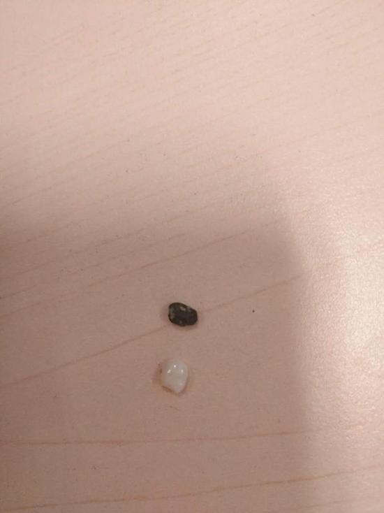 女子买便利店面包后吃出石头还崩掉牙 理赔曲折 女子买便利店面包后吃出石头还崩掉牙 理赔曲折