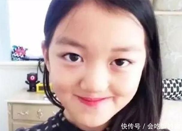 王菲的女儿李嫣3次整容,成功修复兔唇,网友:美