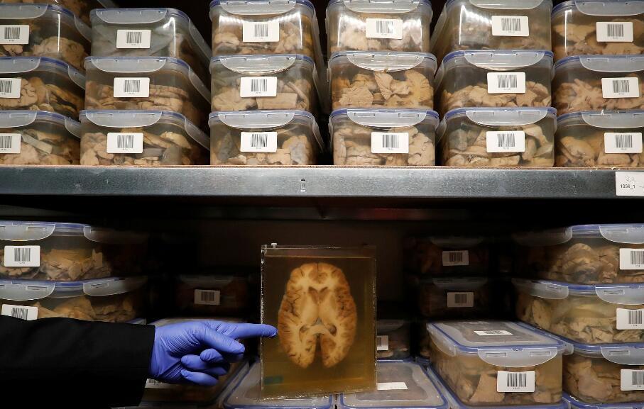 比利时一精神病医院,陈列3千多颗人脑标本,现场如同恐怖电影!