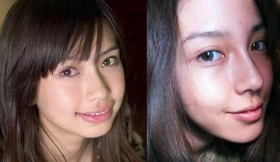 Angelababy杨幂都动过牙,哪些人整牙之后可以